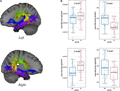 A Diffusion Tensor Imaging Study on the White Matter Structures Related to the Phonology in Cantonese–Mandarin Bilinguals